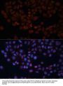 Mitochondrial Import Receptor Subunit TOM70 (TOMM70) Antibody