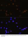 Retinoblastoma Protein 1 (RB1) Antibody