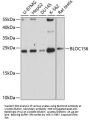 Biogenesis of Lysosomal Organelles Complex 1 Subunit 6 (BLOC1S6) Antibody