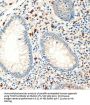 Forkhead Box Protein P3 (FOXP3) Antibody
