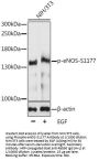 NOS3 (pS1177) Antibody