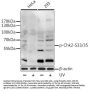 CHEK2 (pS33 / 35) Antibody
