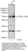STK11 (pT189) Antibody