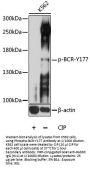 BCR (pY177) Antibody