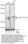 EIF4EBP1 (pT36) Antibody