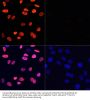 Histone H3 Acetyl-Lys9 (H3 AcK9) Antibody