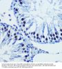 Bromodomain-Containing Protein 4 (BRD4) Antibody