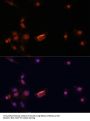 Breast Cancer Type 2 Susceptibility Protein (BRCA2) Antibody