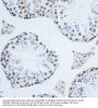 High Mobility Group Protein B1 (HMGB1) Antibody