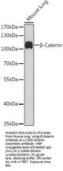beta Catenin (CTNNB1) Antibody