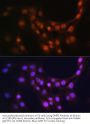 Glia Maturation Factor Beta (GMFB) Antibody