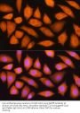 Glia Maturation Factor Beta (GMFB) Antibody