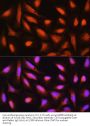 Glia Maturation Factor Beta (GMFB) Antibody
