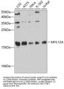 Myosin Light Chain 12A (MYL12A) Antibody