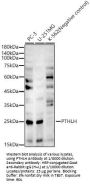 Parathyroid Hormone-Related Protein / PTHrP (PTHLH) Antibody