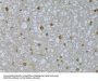 Hepatoma Derived Growth Factor-Related Protein 3 (HDGFRP3) Antibody
