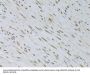 Hepatoma Derived Growth Factor-Related Protein 3 (HDGFRP3) Antibody