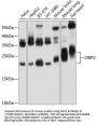 Cysteine-Rich Protein 2 (CRIP2) Antibody
