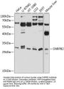 Small Nuclear Ribonucleoprotein Polypeptide B2 (SNRPB2) Antibody