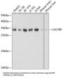 Calcyclin Binding Protein (CACYBP) Antibody