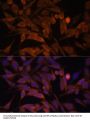 Calcyclin Binding Protein (CACYBP) Antibody