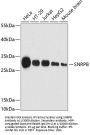 Small Nuclear Ribonucleoprotein Polypeptides B And B1 (SNRPB) Antibody