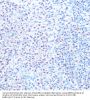 Small Nuclear Ribonucleoprotein Polypeptides B And B1 (SNRPB) Antibody