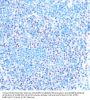 Small Nuclear Ribonucleoprotein Polypeptides B And B1 (SNRPB) Antibody