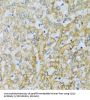 Complement Component 1q Subcomponent C (C1qC) Antibody