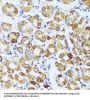 Complement Component 1q Subcomponent C (C1qC) Antibody