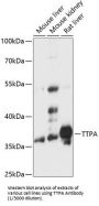 Alpha Tocopherol Transfer Protein (TTPA) Antibody