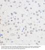 CCR4-NOT Transcription Complex Subunit 7 (CNOT7) Antibody