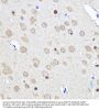 CCR4-NOT Transcription Complex Subunit 7 (CNOT7) Antibody