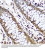 CCR4-NOT Transcription Complex Subunit 7 (CNOT7) Antibody