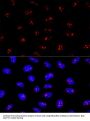 EBNA1 Binding Protein 2 (EBNA1BP2) Antibody