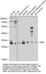 Ribose-5-Phosphate Isomerase (RPIA) Antibody