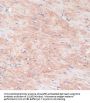 Ribose-5-Phosphate Isomerase (RPIA) Antibody