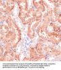 Ribose-5-Phosphate Isomerase (RPIA) Antibody