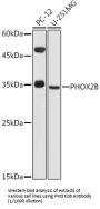 Paired Like Homeobox 2b (PHOX2B) Antibody