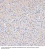Cyclin-Dependent Kinase 9 (CDK9) Antibody