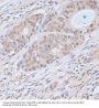 Cyclin-Dependent Kinase 9 (CDK9) Antibody
