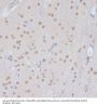 Cyclin-Dependent Kinase 9 (CDK9) Antibody