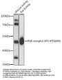 Prostaglandin E2 Receptor EP3 Subtype (PTGER3) Antibody