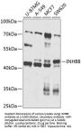 Inhibin Beta B (INHBB) Antibody