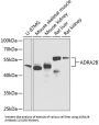 Alpha 2B Adrenergic Receptor (ADRA2B) Antibody