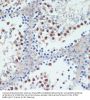Retinoic Acid Receptor RXR-Gamma (RXRG) Antibody