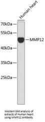 Matrix Metalloproteinase 12 (MMP12) Antibody