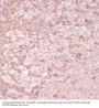 Cytochrome P450 11B2 (CYP11B2) Antibody