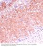 Cytochrome P450 11B2 (CYP11B2) Antibody