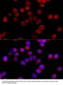 Cytochrome P450 11B2 (CYP11B2) Antibody